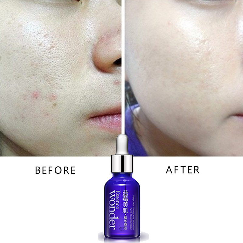 BIOAQUA Blueberry Face Lifting - Skincare Garnier review and price