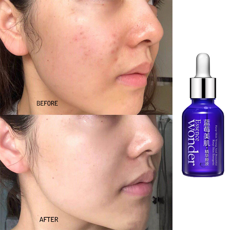 BIOAQUA Blueberry Face Lifting - Skincare Garnier review and price