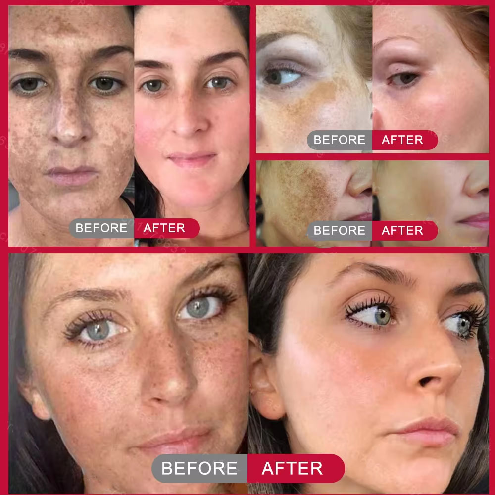 Powerful Spot-removing Whiteni - Skincare Vitamin C review and price