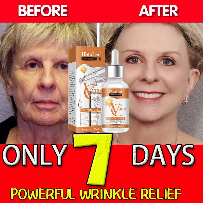 Premium 30% Vitamin C Serum Fo - Skincare Garnier review and price