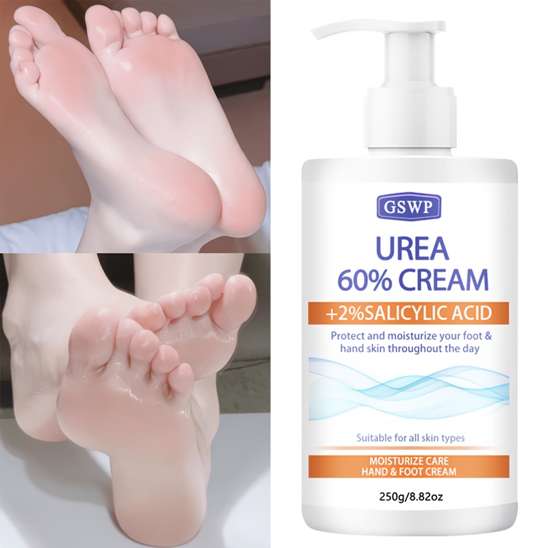 GSWP 60% Urea Moisturising Han - Azelaic Acid Cream review and price