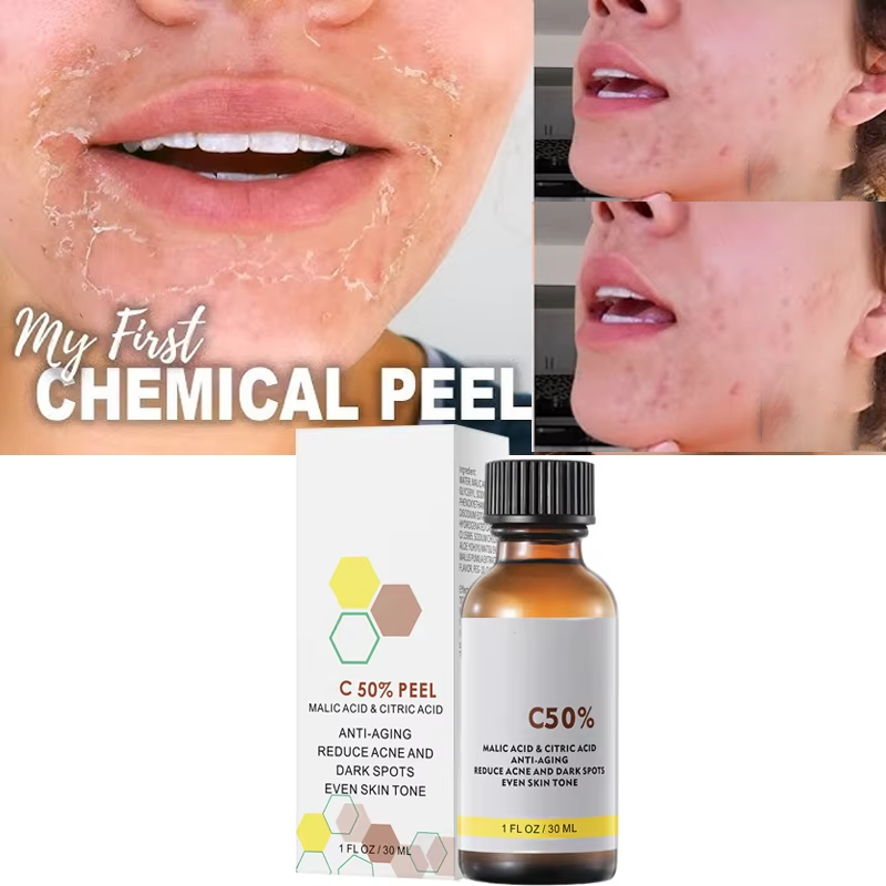 With Malic Acid And Citric Aci - Salicylic Acid Cleanser review and price