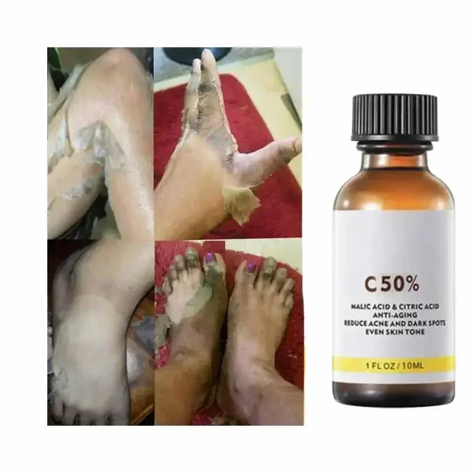 With Malic Acid And Citric Aci - Salicylic Acid Cleanser review and price